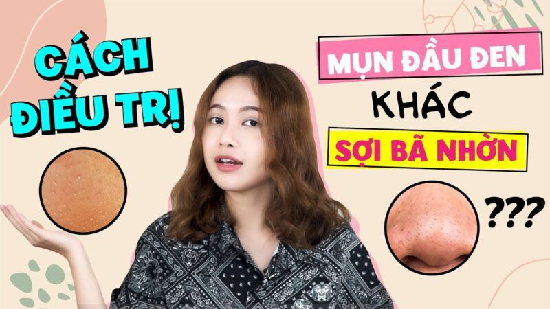 Mụn đầu đen là gì? Nguyên nhân gây mụn đầu đen và giải pháp trị mụn an toàn cách trị mụn đầu đen