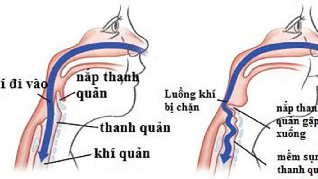 Hô hấp có vai trò quan trọng như thế nào với cơ thể sống?