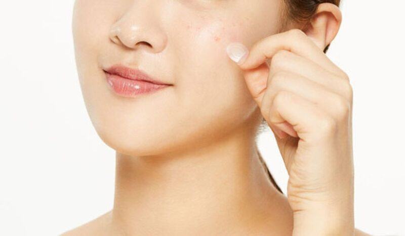 Mụn đầu đen là gì? Nguyên nhân gây mụn đầu đen và giải pháp trị mụn an toàn nguyên nhân, cách trị mụn đầu đen