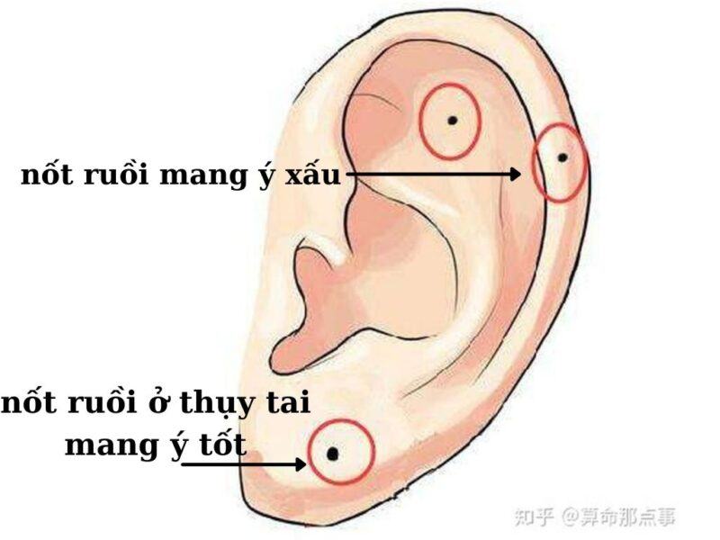nốt ruồi phụ nữ mọc ở đâu thì giàu